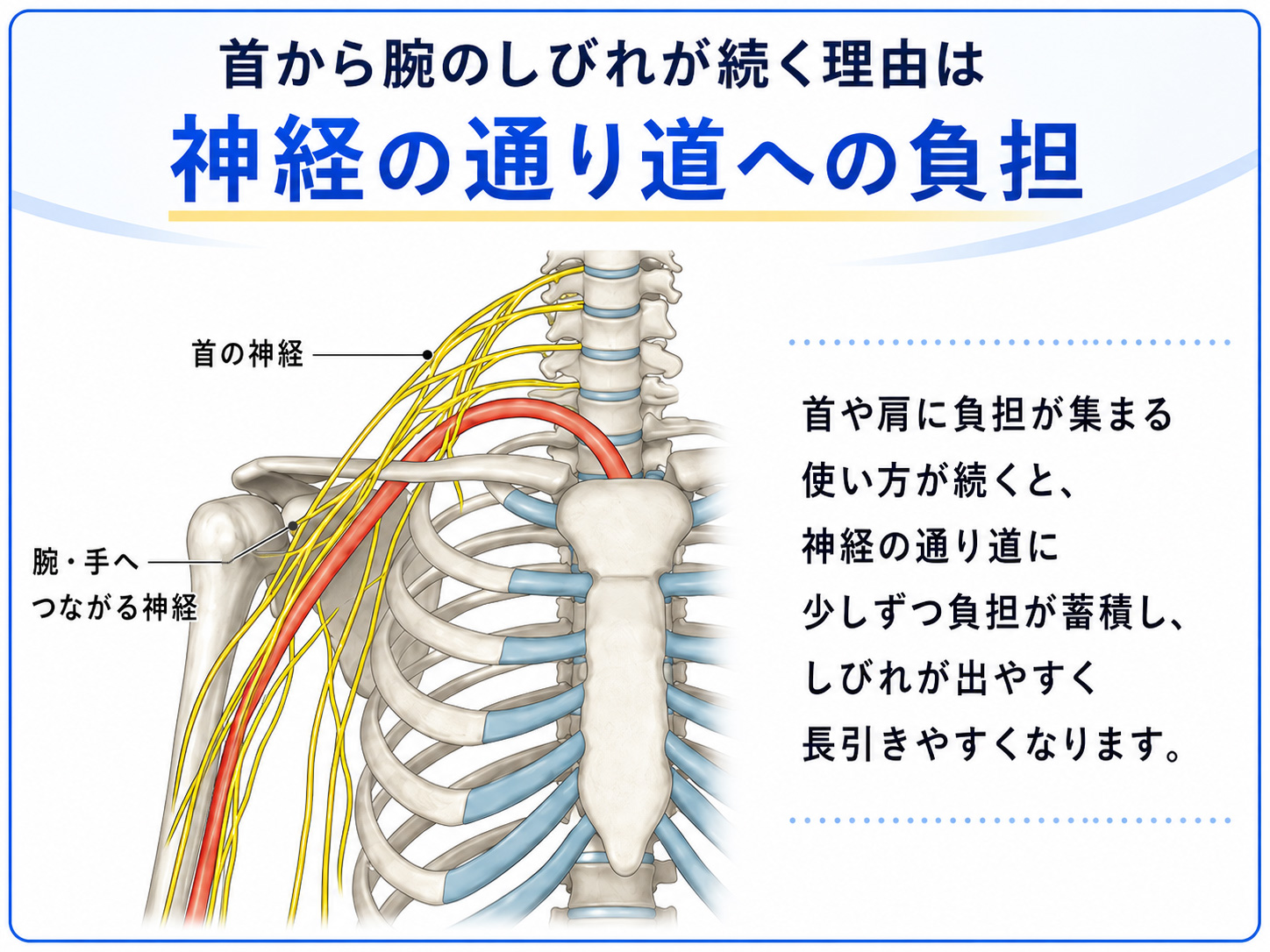 手のしびれ・腕のしびれが起こるしくみの図解