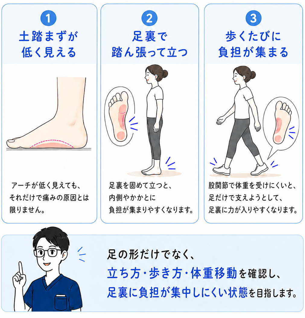 偏平足は土踏まずの形だけで判断するのではなく、足裏で体重をどう受けているか、足裏に負担が集中していないかを見ることが大切であることを説明した図