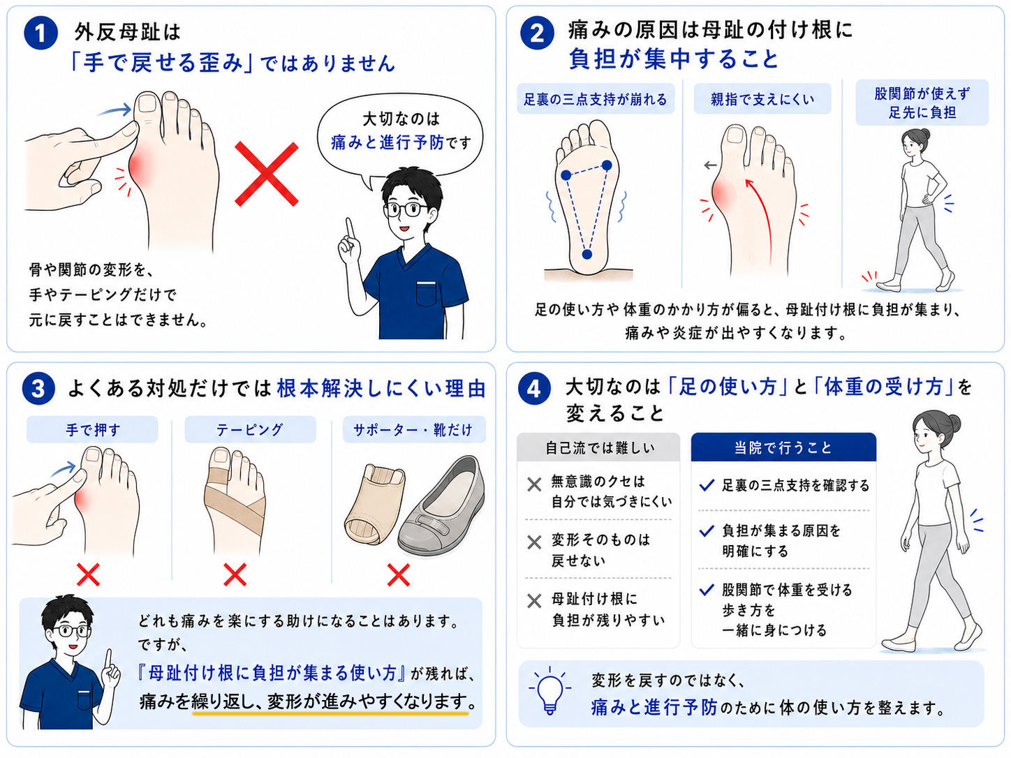 外反母趾の変形そのものを戻す方法は基本的に手術であり、整体や手技では変形を戻せないこと、当院では痛みと進行予防のために足の使い方と体重の受け方を整えることを説明した図
