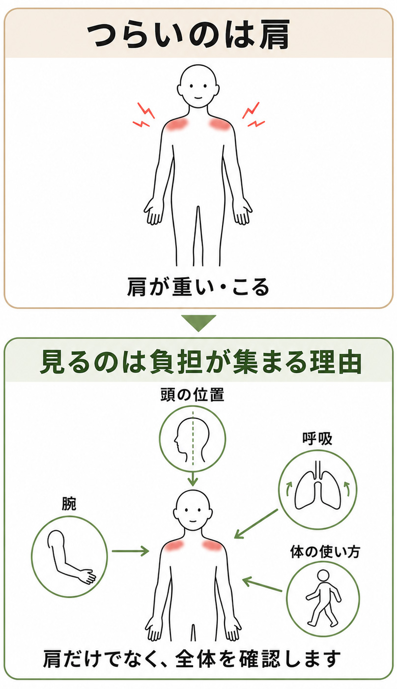 肩のつらさだけでなく、頭の位置、呼吸、腕、体の使い方など、肩へ負担が集まる理由を確認する図