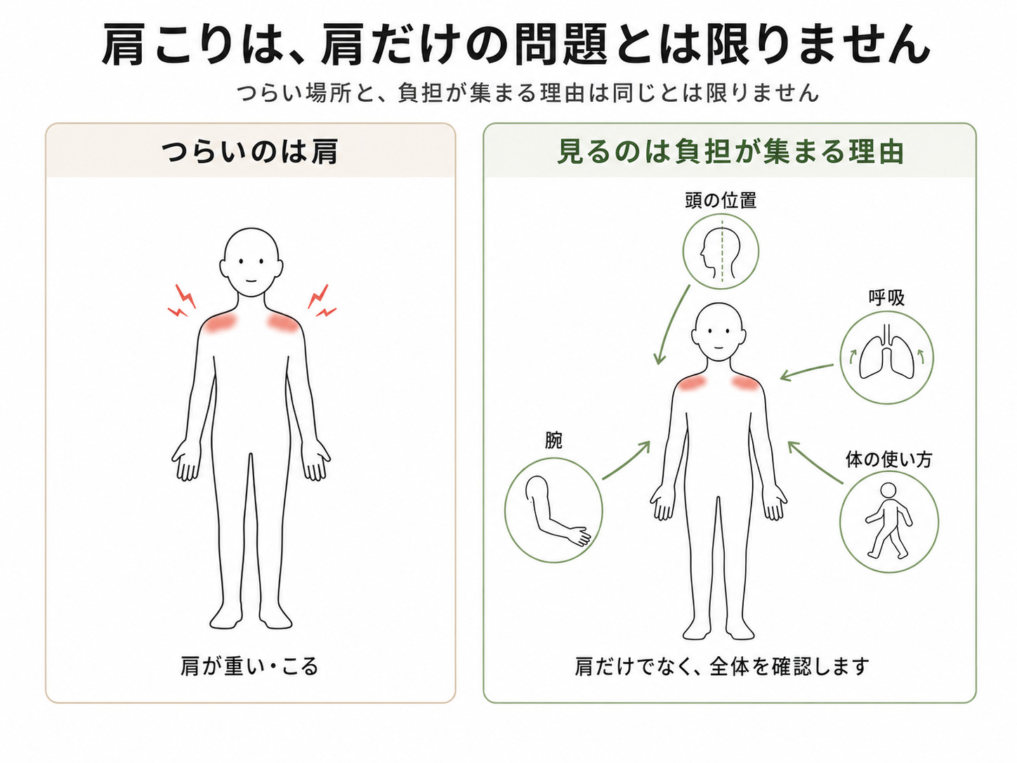 肩のつらさだけでなく、頭の位置、呼吸、腕、体の使い方など、肩へ負担が集まる理由を確認する図