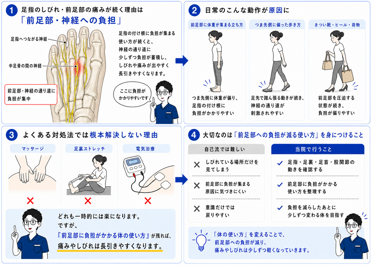 モートン病で足指の付け根に負担が集まるしくみの図解