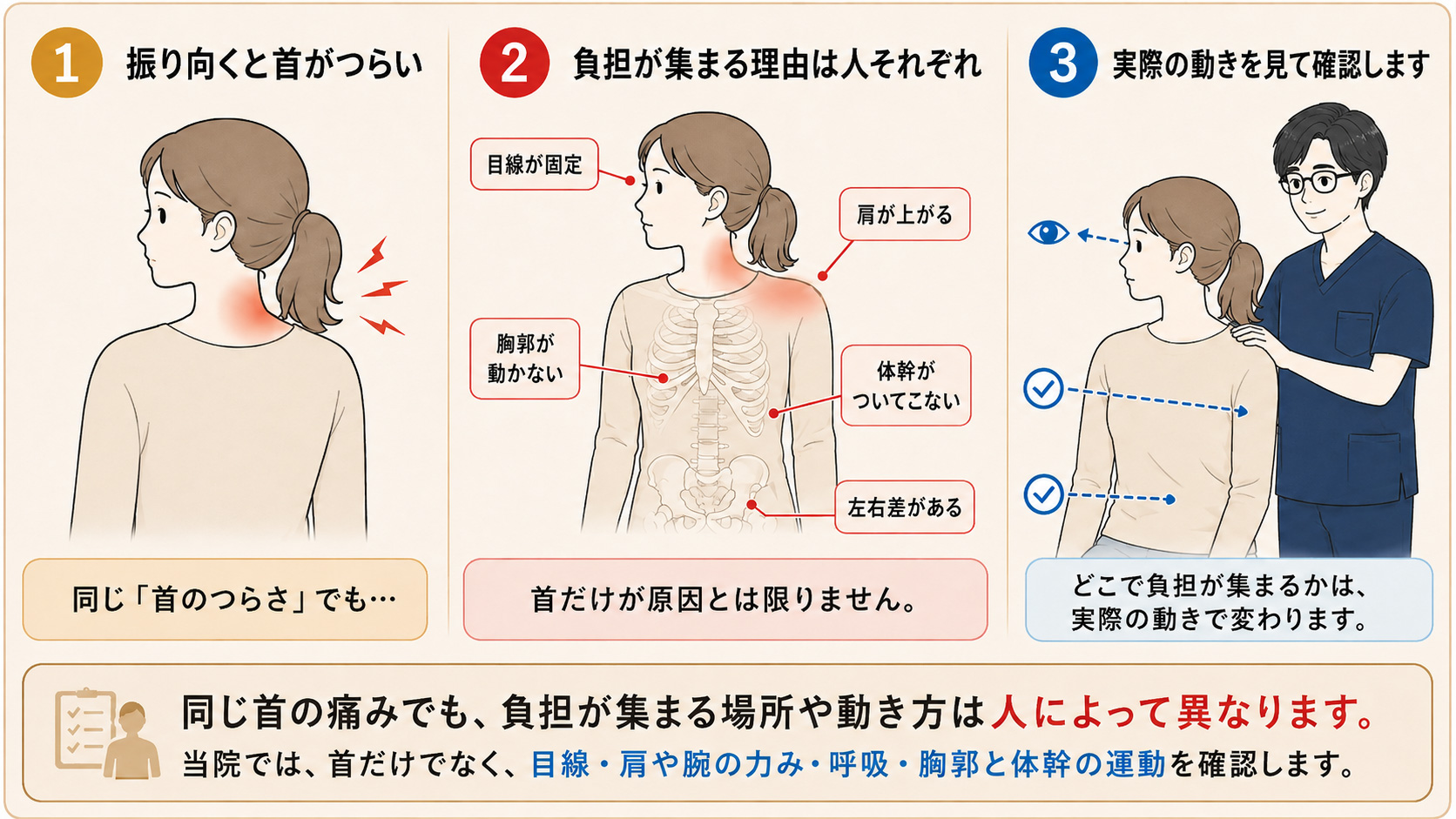 首だけを固めて振り向く場合と、目線・胸郭・体幹が連動して振り向く場合では首への負担が変わることを示した図