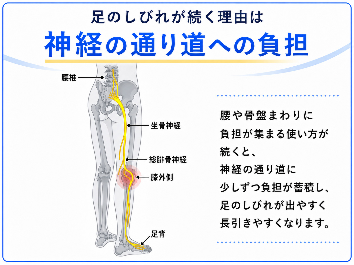 足のしびれ・足先のしびれが起こるしくみの図解