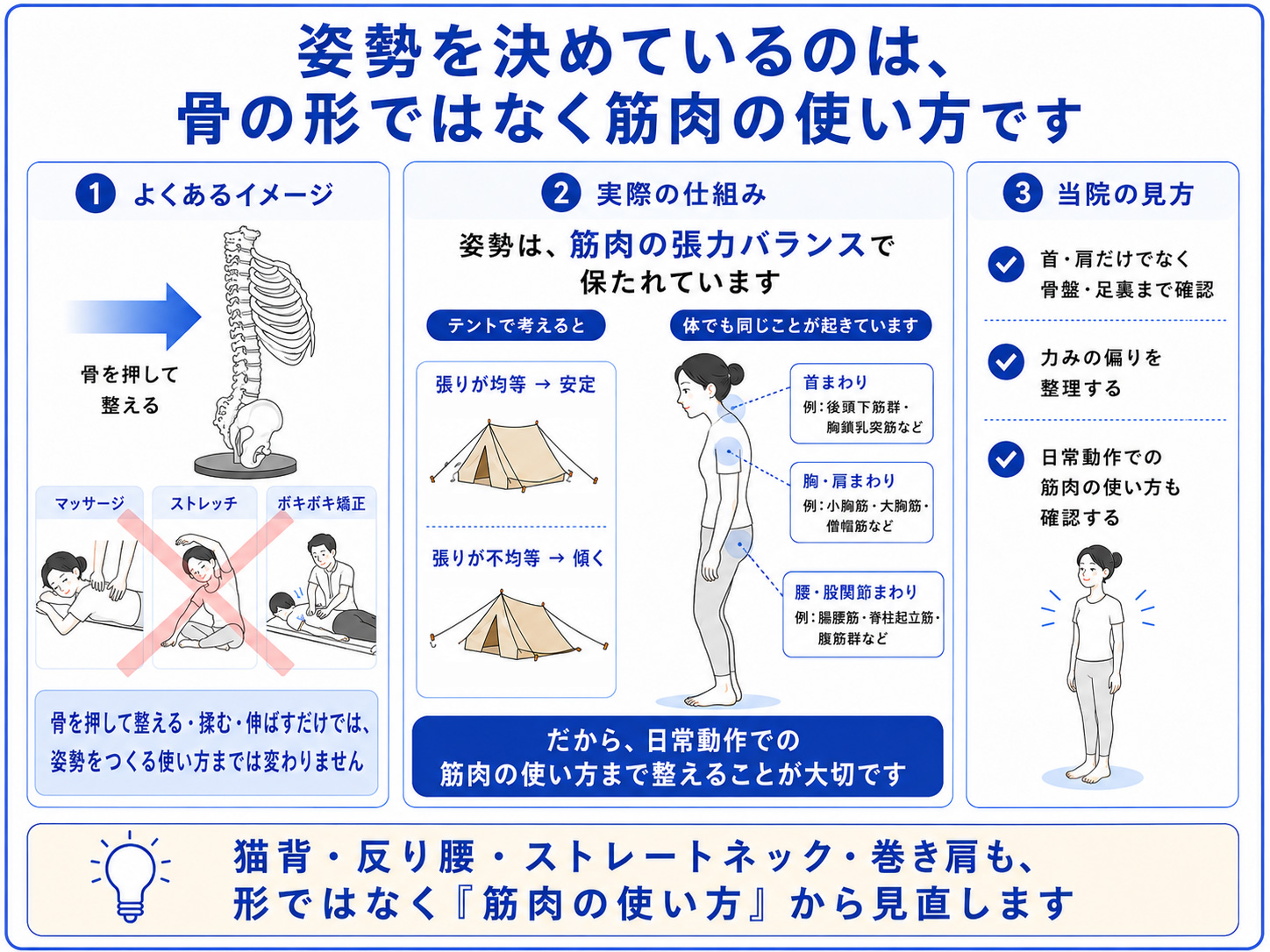 猫背・反り腰・ストレートネック・巻き肩は、骨の形ではなく筋肉の使い方や張力バランスが関係することを説明した図