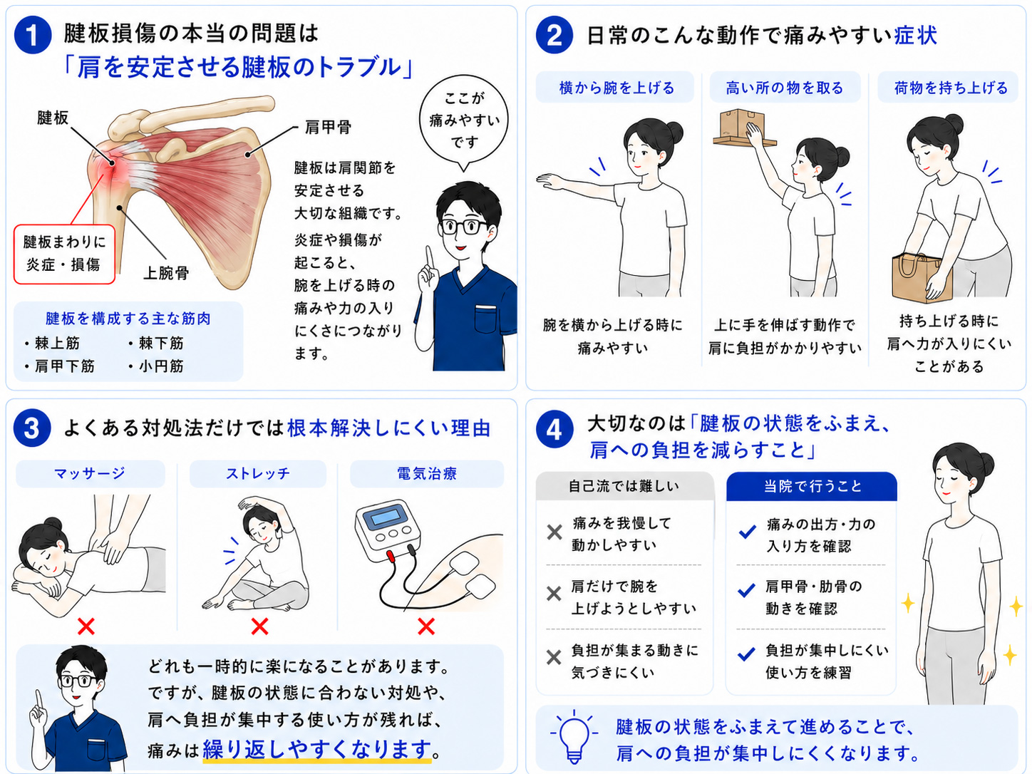 腱板損傷が起こるしくみの図解