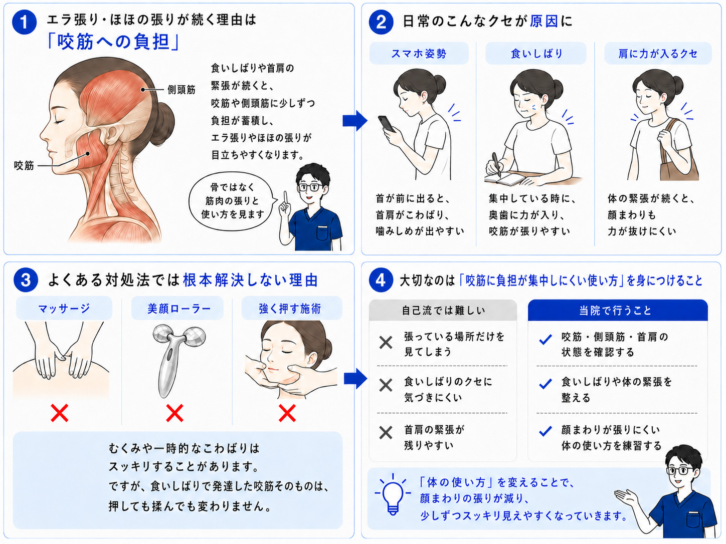 小顔矯正で見る咬筋への負担と食いしばりの図解
